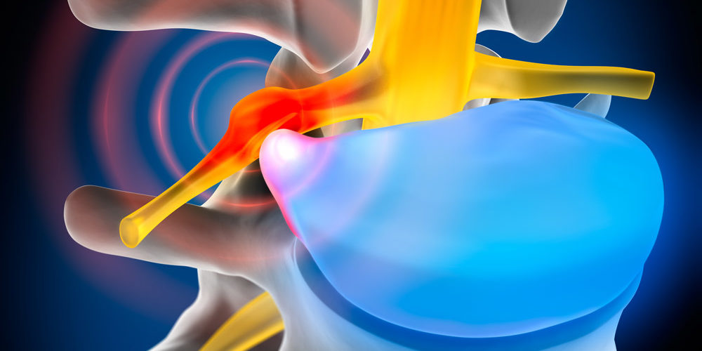 Ten Oaks CORRECTIVE CARE