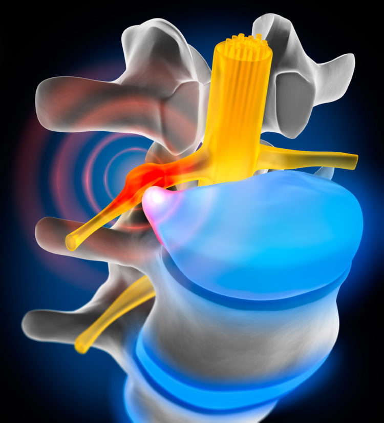 Ten Oaks CORRECTIVE CARE