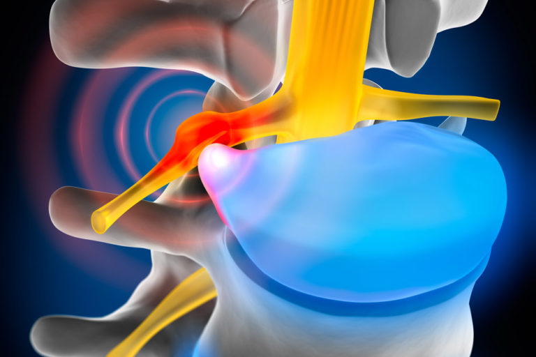 Ten Oaks CORRECTIVE CARE